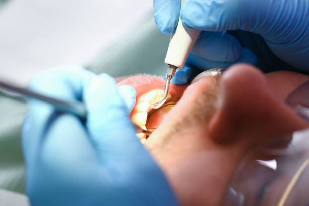 Best Cracked Tooth Emergency Dentist  in Oakdale, MN